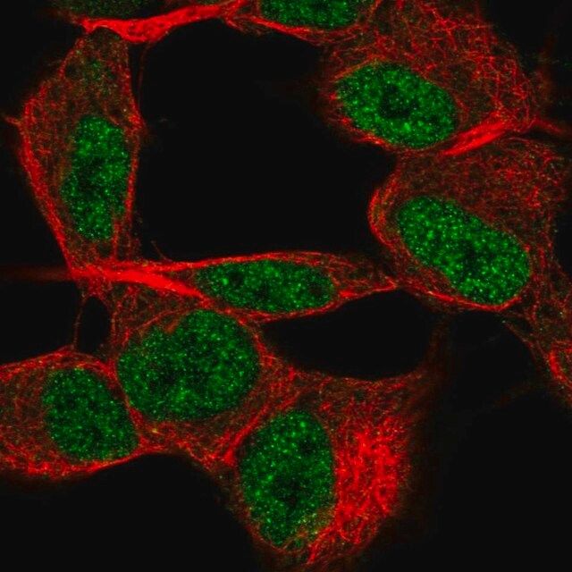 Anti-TSTD2 antibody produced in rabbit