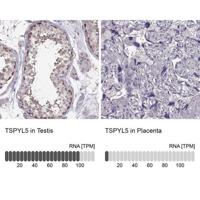 Anti-TSPYL5 antibody produced in rabbit