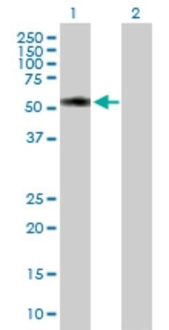 Anti-TTC31 antibody produced in mouse