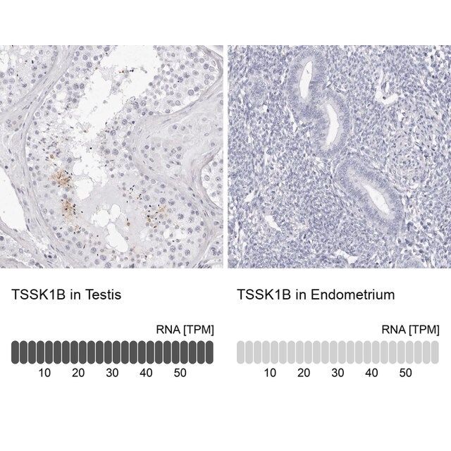 Anti-TSSK1B antibody produced in rabbit