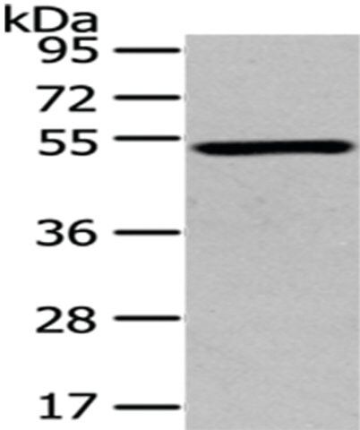 Anti-TSPYL1