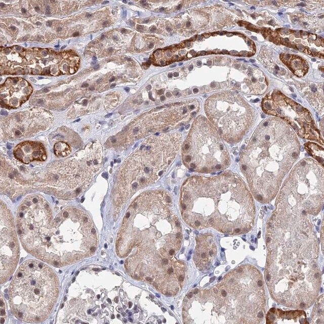 Anti-TSSC4 antibody produced in rabbit