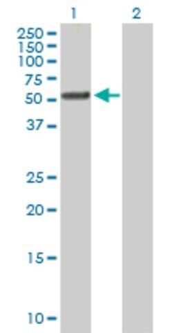 Anti-TTC8 antibody produced in mouse