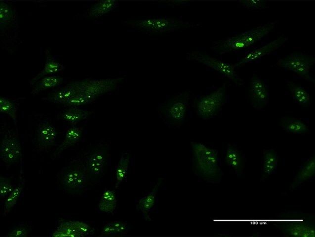 Anti-TSPYL6 antibody produced in mouse