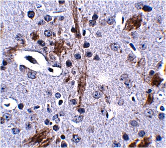 Anti-TTBK1 Antibody