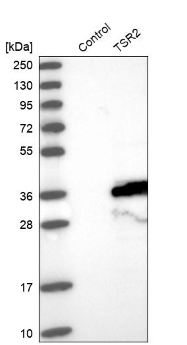 Anti-TSR2 antibody produced in rabbit