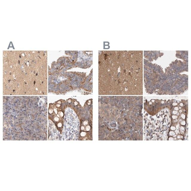 Anti-TSPOAP1 antibody produced in rabbit