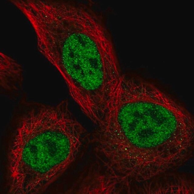 Anti-TSSC4 antibody produced in rabbit