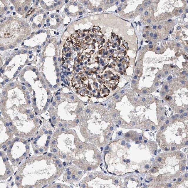 Anti-TSPAN33 antibody produced in rabbit