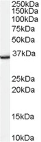 Anti-TSPO/PBR (Isoform) antibody produced in goat