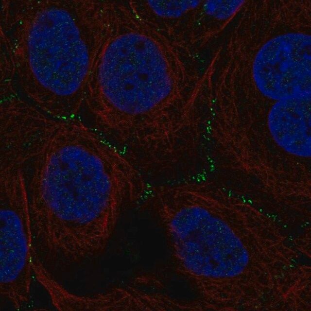 Anti-TSSK4 antibody produced in rabbit