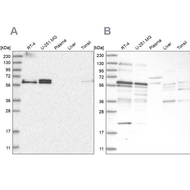 Anti-TSPYL1 antibody produced in rabbit