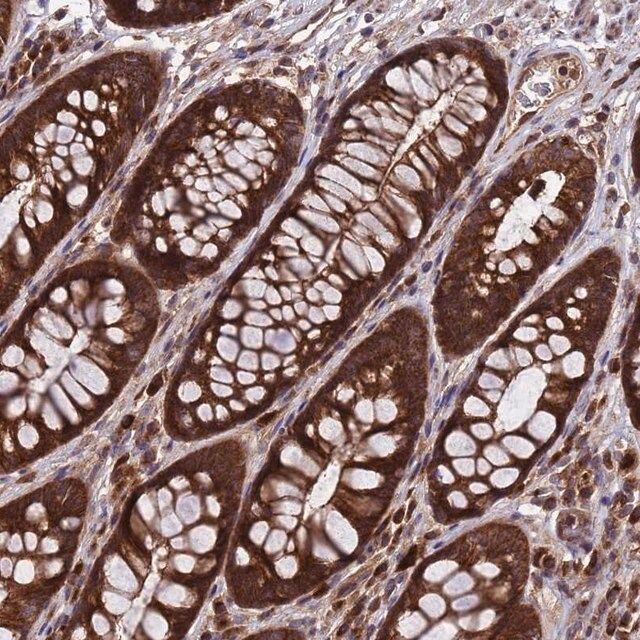 Anti-TSR3 antibody produced in rabbit