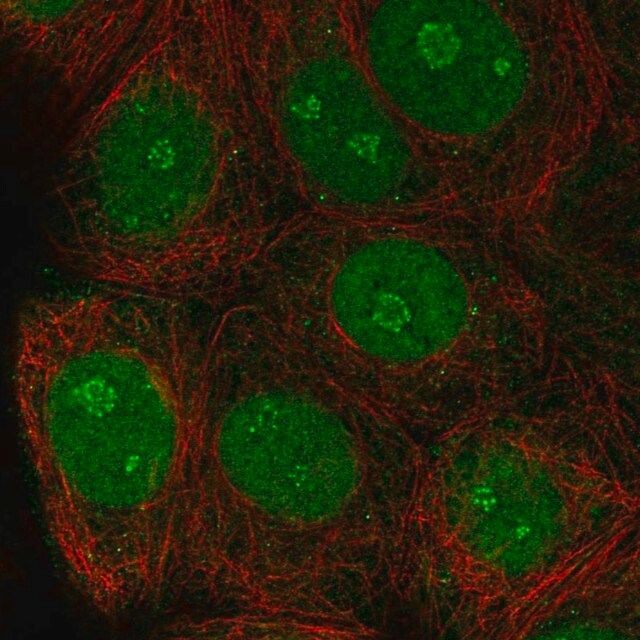 Anti-TSSC1 antibody produced in rabbit