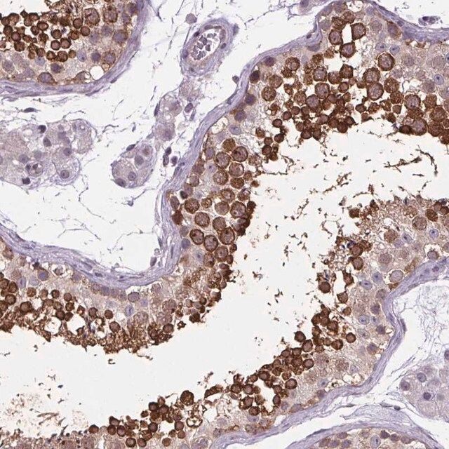 Anti-TTC12 antibody produced in rabbit