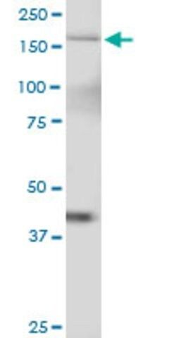 Anti-TTBK2 antibody produced in mouse