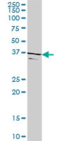 Anti-TSSK2 antibody produced in rabbit