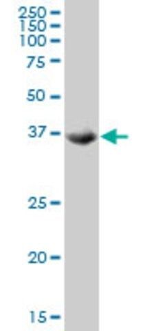 ANTI-TSSK2 antibody produced in mouse