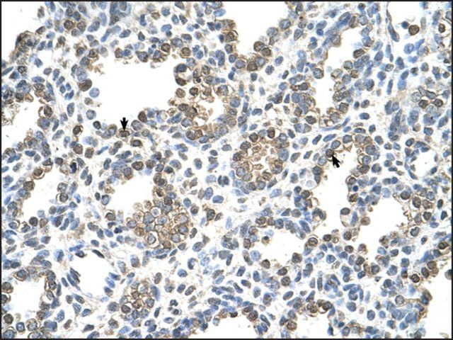 Anti-TST antibody produced in rabbit