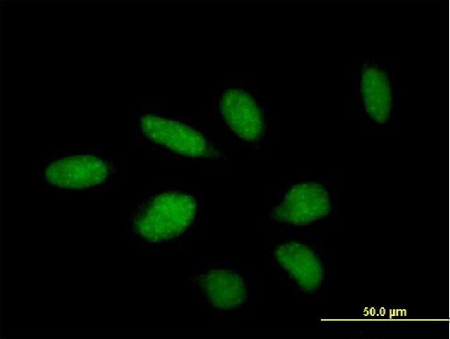 Anti-TTC23 antibody produced in mouse