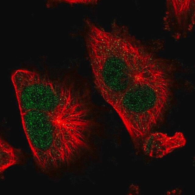 Anti-TSR1 antibody produced in rabbit