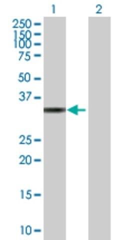 Anti-TP53I3 antibody produced in mouse