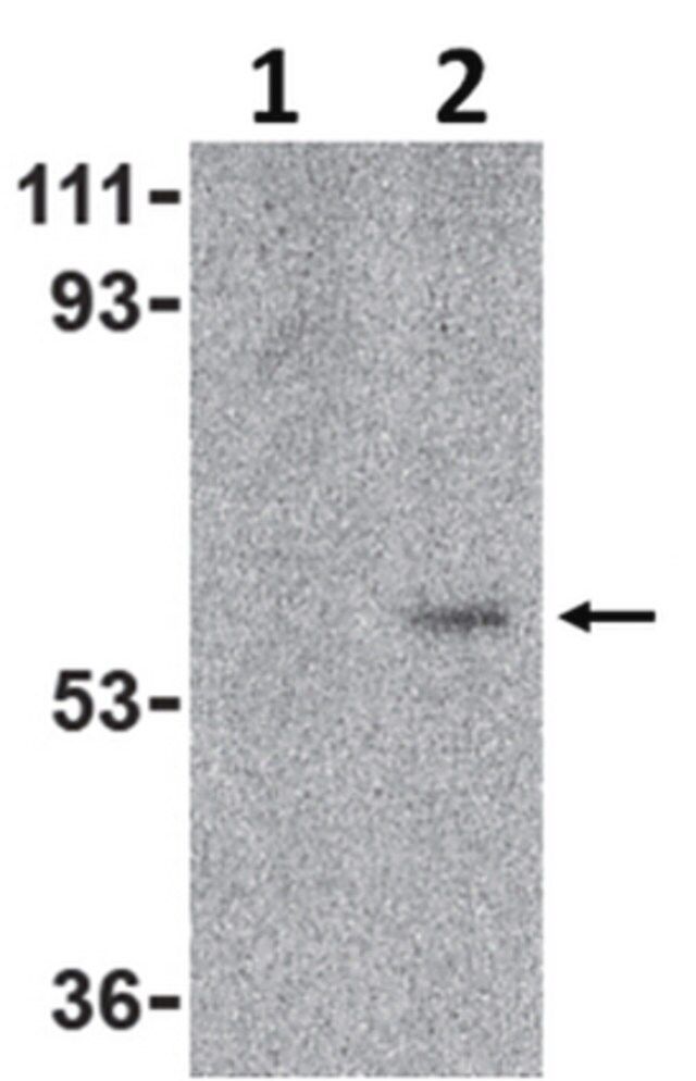 Anti-Toso Antibody