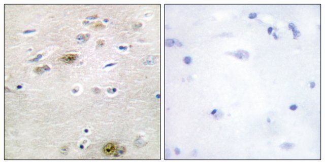 Anti-TRA-2  antibody produced in rabbit