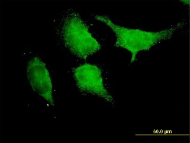 Anti-TRAF6 antibody produced in mouse