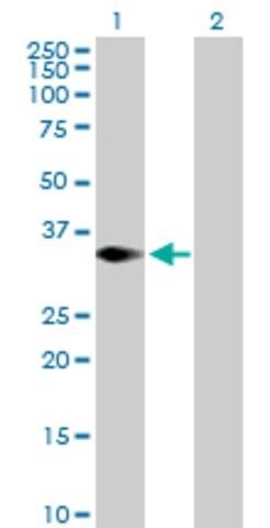 Anti-TRIM4 antibody produced in mouse