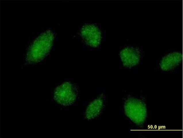 Anti-TRIM45 antibody produced in mouse