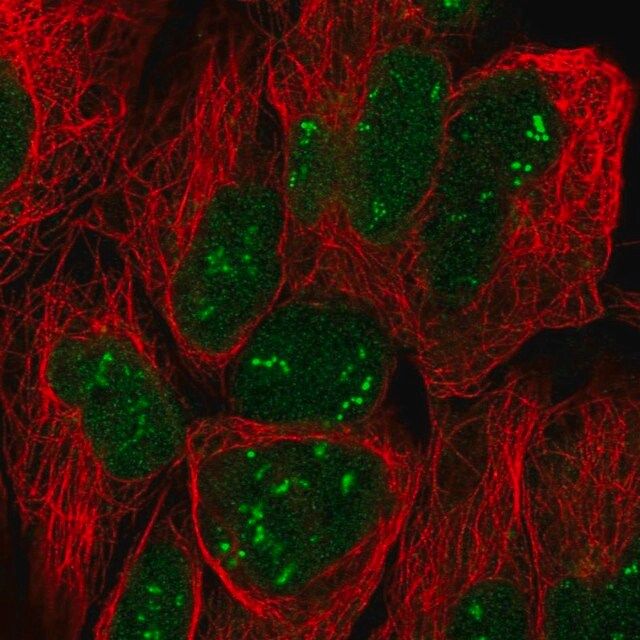 Anti-TRO antibody produced in rabbit