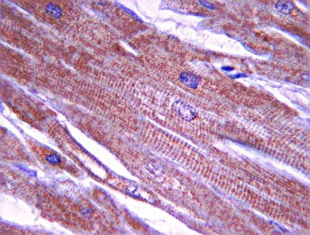 Anti-Tropomyosin Antibody, clone 15D12.2