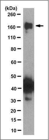 Anti-TRPM2 Antibody, clone 9D8.1