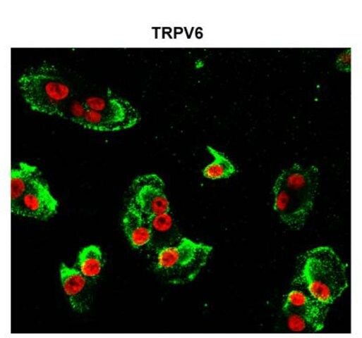 Anti-TRPV6 antibody produced in rabbit