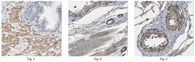 Anti-Tropomyosin 4 Antibody