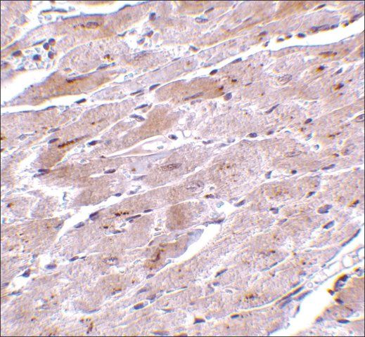 Anti-TRPC3 (ab1) antibody produced in rabbit