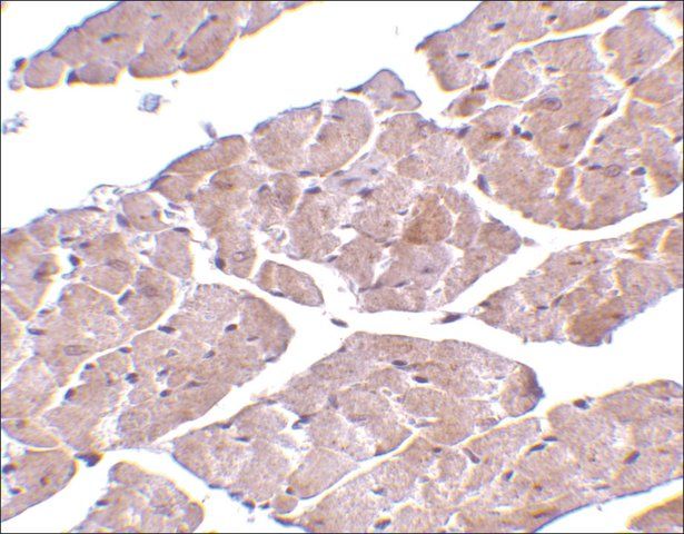 Anti-TRPC3 (ab3) antibody produced in rabbit