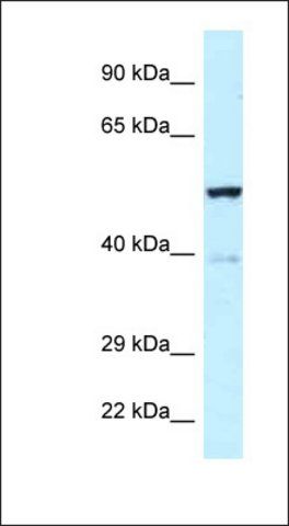 Anti-TRP63 antibody produced in rabbit