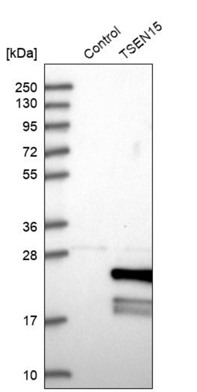 Anti-TSEN15 antibody produced in rabbit