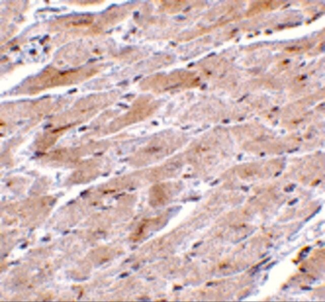 Anti-TRPC3 antibody produced in rabbit