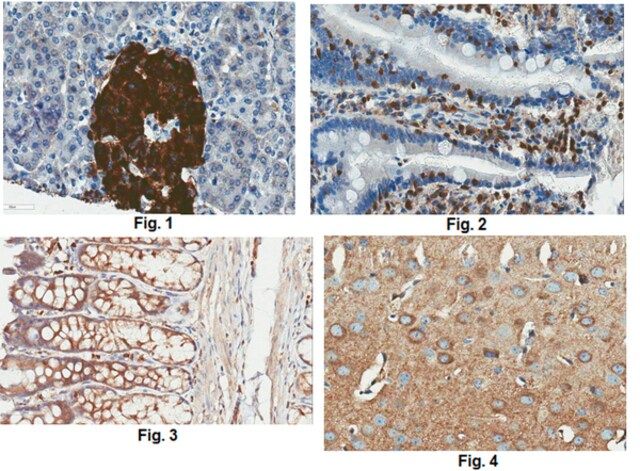 Anti-TrpV6 Antibody, clone 4A5.1