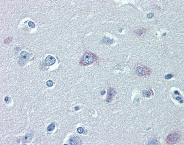 Anti-TRPM2 antibody produced in rabbit