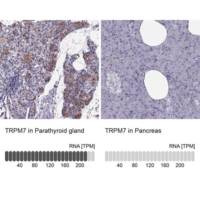 Anti-TRPM7 antibody produced in rabbit