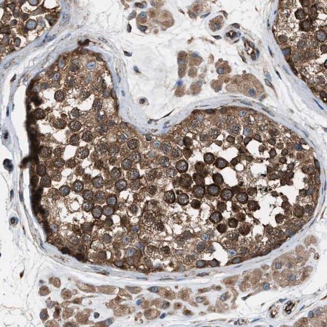 Anti-TRPC1 antibody produced in rabbit