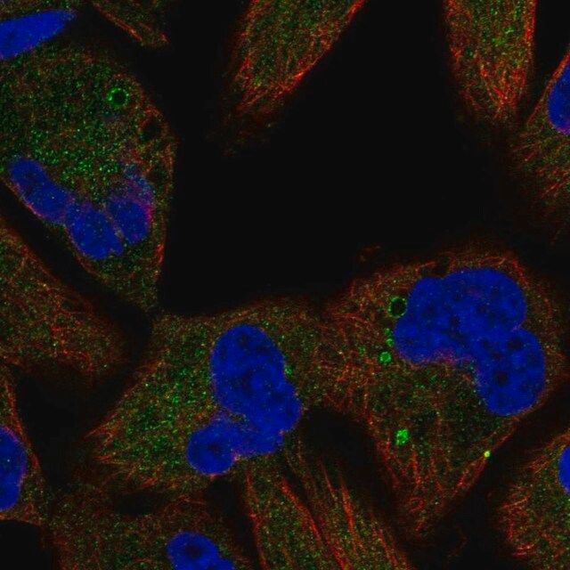 Anti-TSC1 antibody produced in rabbit