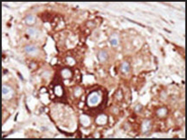 Anti-TRRAP (center) antibody produced in rabbit