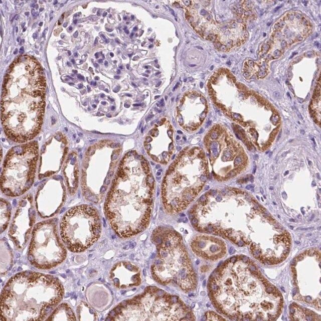 Anti-TRPV5 antibody produced in rabbit