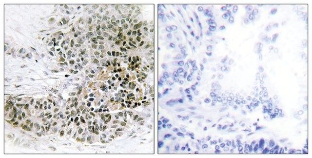 Anti-TRPS1 antibody produced in rabbit