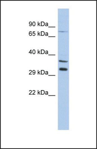 Anti-TSGA13 antibody produced in rabbit